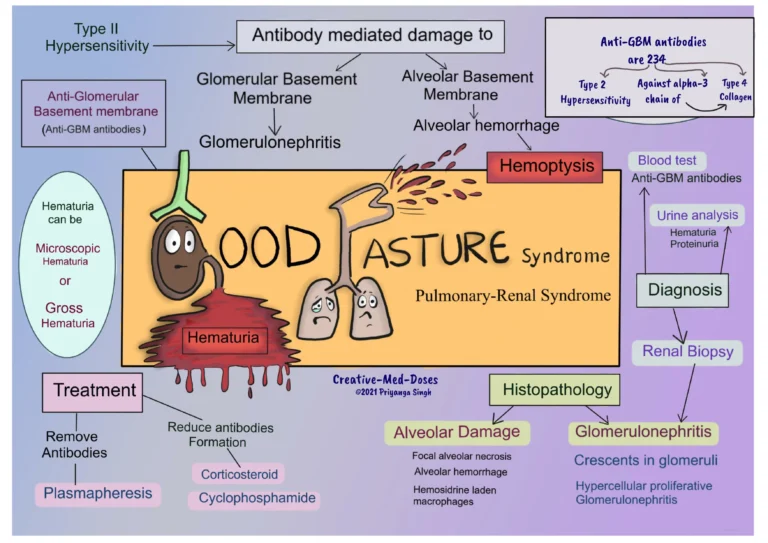 Goodpasture’s Syndrome Goodpasture's Syndrome