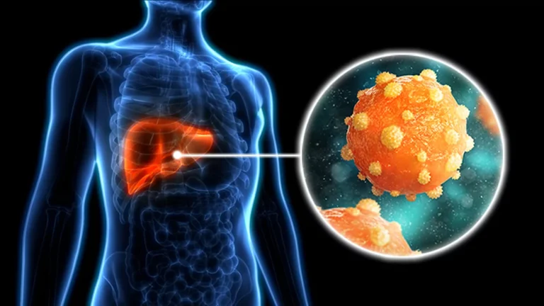 Understanding Hepatitis B: Transmission, Symptoms, and Prevention Hepatitis B