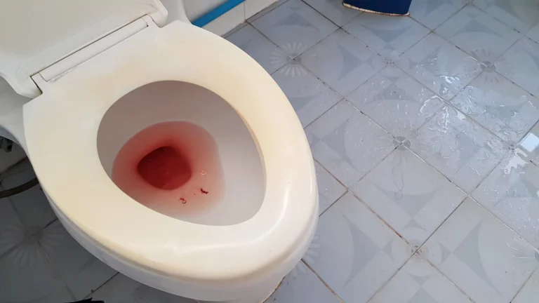 Urinating Blood After Sex Urinating Blood